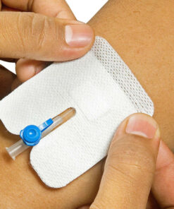 پسب  چسب آنژیوکت ساده