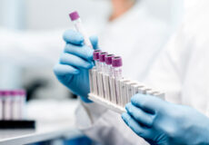 تاثیر هورمونها بر خلق و خو و پوست