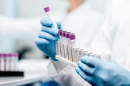 تاثیر هورمونها بر خلق و خو و پوست