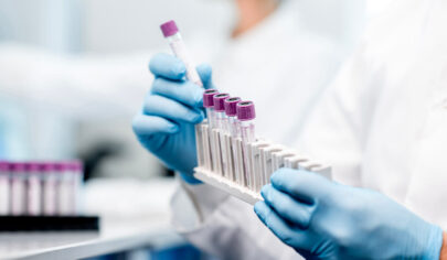 تاثیر هورمونها بر خلق و خو و پوست