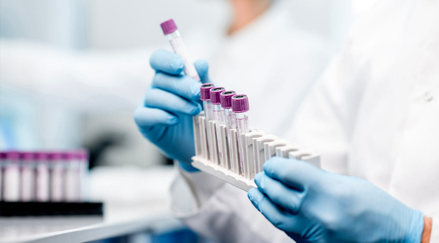 تاثیر هورمونها بر خلق و خو و پوست